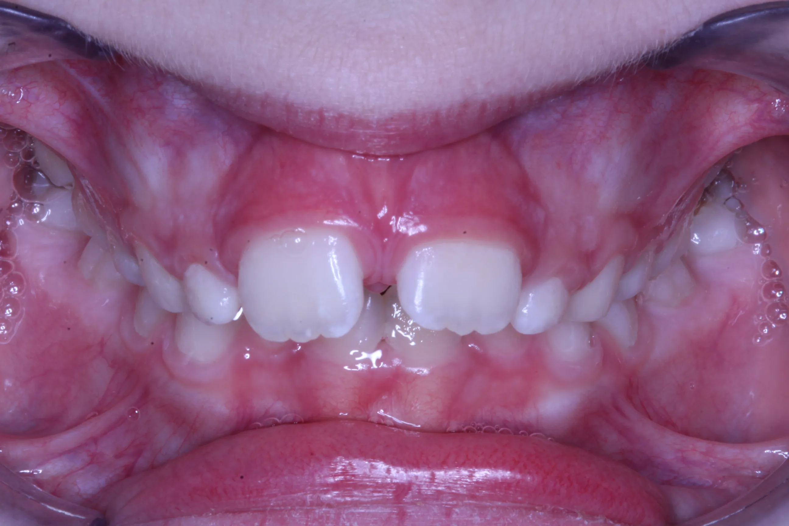 smile-gallery gallery